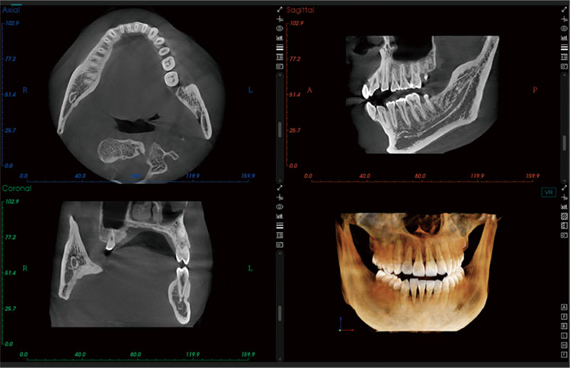 CBCT MEYER DENTAL