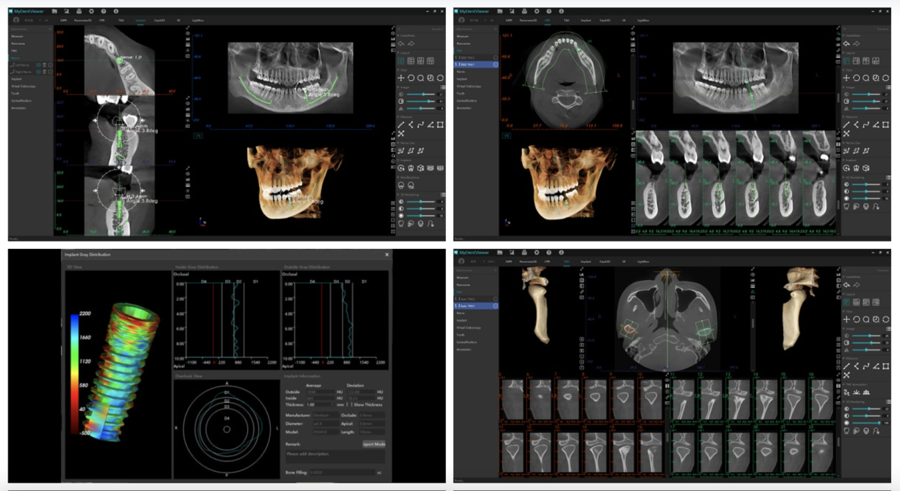 Logiciel de diagnostique intelligent