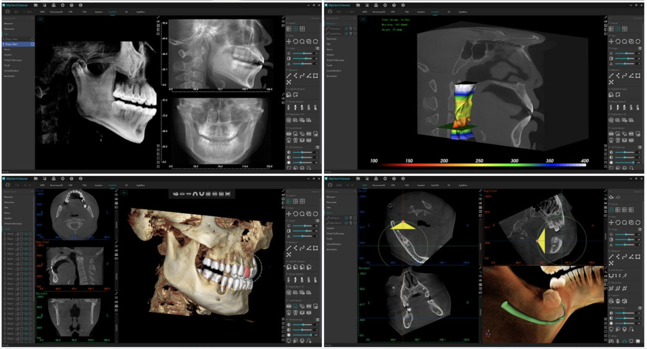 Smart Diagnostic Software Meyer Dental France