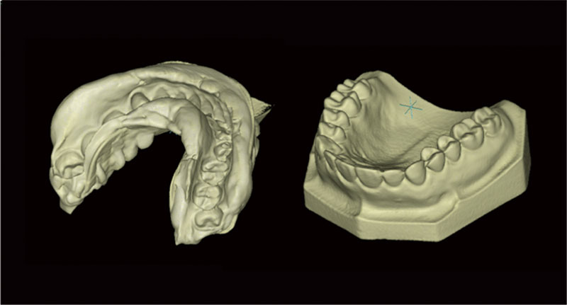 MODEL SCANNING MEYER DENTAL